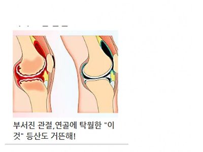 디씨인의 이상성욕..