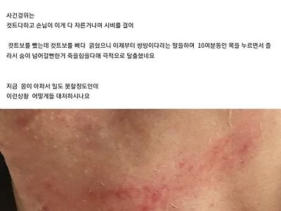 커트 맘에 안든다고 미용사 목 조른 사람