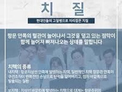 대표적인 항문 질환