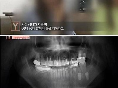 면허 정지 1개월 억울한 치과 의사