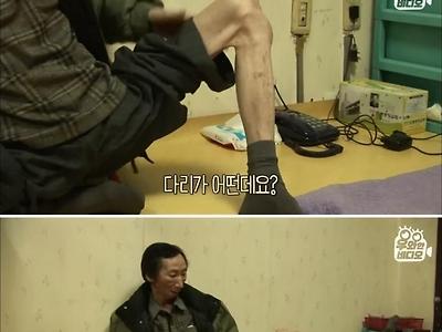 스압) 양쪽 다리가 직각으로 굳은 채 평생을 살아온 남자