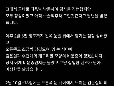블라인드 시력교정 부작용글 무섭네 jpg
