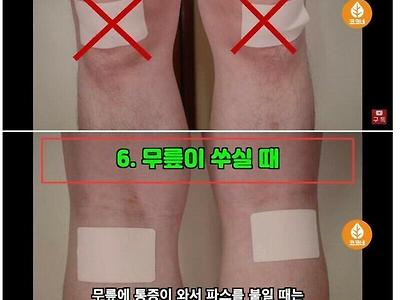 파스 제대로 붙이는 법