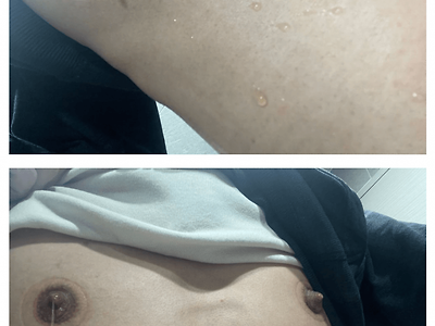 유두부항을 끼고 잔 남자??!.jpg