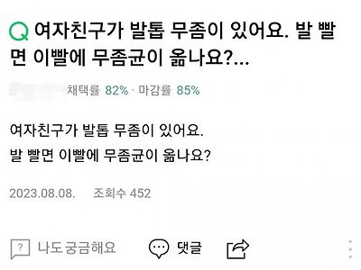 여자친구가 발톱 무좀이 있어요