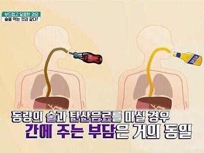 의사: 탄산음료는 술만큼해로워요