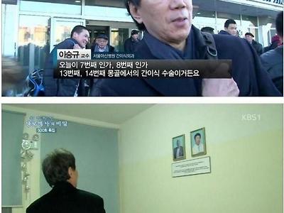 세계 최고 간이식 수술 전문가의 위엄.jpg