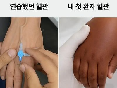 이해가 한번에 됨ㅋ