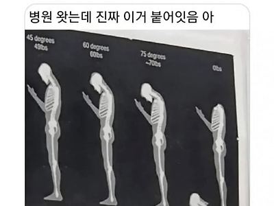 헉..진짜 병원에 이런게 있다고?