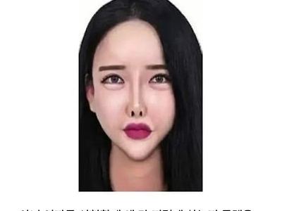 이해안된다는 여자 성형