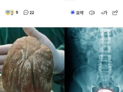이게 실화냐