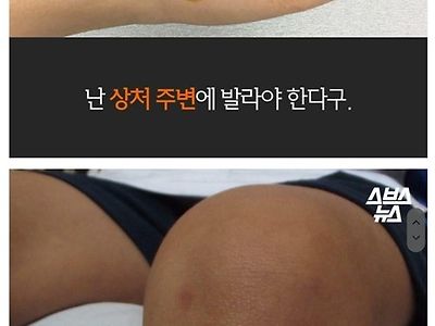 한때 논란이었던 빨간약