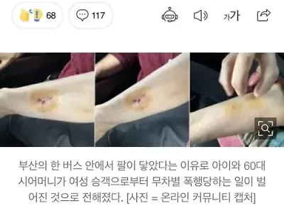 팔 닿았다고