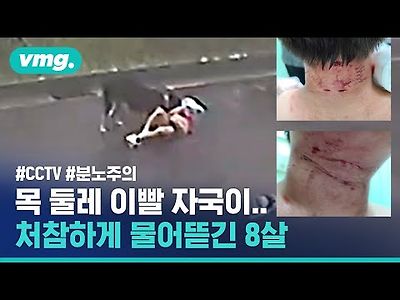 목줄 없는 개에 '사냥' 당한 초등학생…택배기사가 살렸다