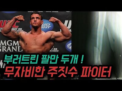 전세계가 보는 생방송 도중 부러트린 팔만 두 개 !! 인간이길 포기한 주짓수 야수