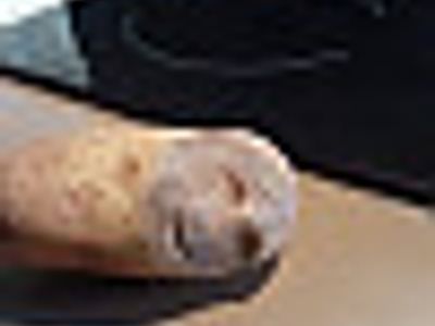 감자 못먹겠다 ㅎ