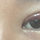 안녕하세요 쌍꺼풀수술후..