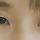 앞트임 해야 할까요?
