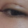 <b>매몰</b> 한달반인데 라인이 끊기는데 이거 흉살인가요?