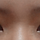 비절개눈매교정후에요 이런 증상들 부작용인걸까여 정상인가여 ㅠㅠ...하(+사진추가요,,,)