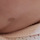 아기 밀크반점이랑 점 있는데