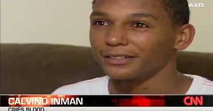 2012년 CNN 헤모라크리아 증상의 소년 | 인스티즈