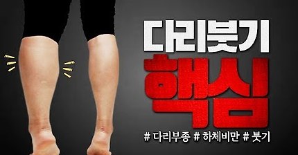 다리붓기가 안 빠지는 진짜 이유(해결방법나옴) | 인스티즈