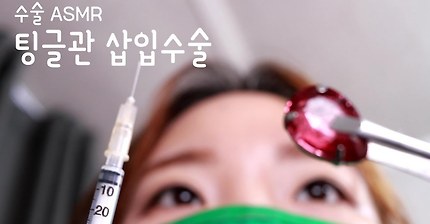 [수술 ASMR] ENG SUB 팅글관 삽입수술 롤플레이｜역대급 팅글｜Surgery Role Play