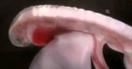 DNA, 100% 신이 있다는 증거. 창조 하나님이 계신다는 증거