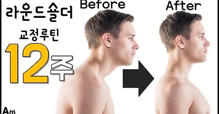 50만명이 효과를 본 라운드숄더 교정루틴 A (by 호주물리치료사) [피지컬갤러리] (eng sub)