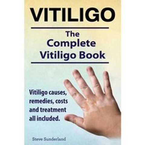 Vitiligo. Vitiligo Causes Remedies Costs and Treatment All Included. the Complete Vitiligo Book. Paperback, Imb Publishing