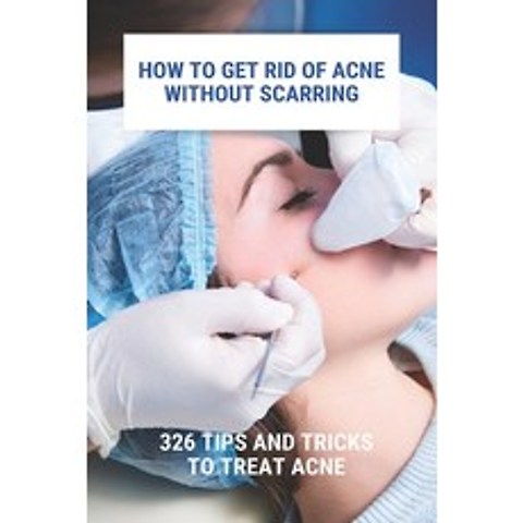 How To Get Rid Of Acne Without Scarring: 326 Tips And Tricks To Treat Acne: Natural Pimples Cure Paperback, Independently Published, English, 9798740539423