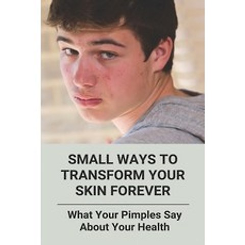 Small Ways To Transform Your Skin Forever: What Your Pimples Say About Your Health: Is Acne Normal Paperback, Independently Published, English, 9798740466507