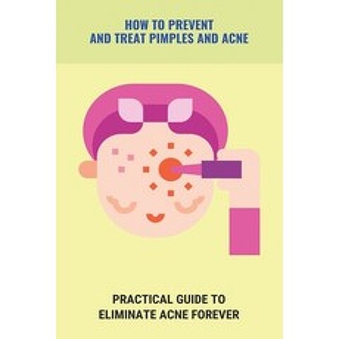 How To Prevent And Treat Pimples And Acne: Practical Guide To Eliminate Acne Forever: Pimples Cure Tips Paperback, Independently Published, English, 9798740551364