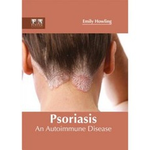 Psoriasis: An Autoimmune Disease Hardcover, Foster Academics
