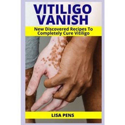 Vitiligo Vanish: Newly Discovered Secret Recipes To Completely Cure Vitiligo Gain Your Self Esteem ... Paperback, Independently Published, English, 9798727097441