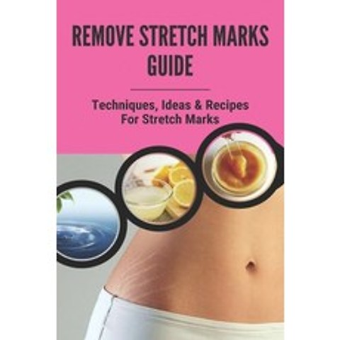 Remove Stretch Marks Guide: Techniques Ideas & Recipes For Stretch Marks: How To Get Rid Of Stretch... Paperback, Independently Published, English, 9798740601168