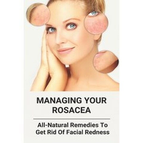 Managing Your Rosacea: All-Natural Remedies To Get Rid Of Facial Redness: Skin Diseases Treatment Paperback, Independently Published, English, 9798740267203