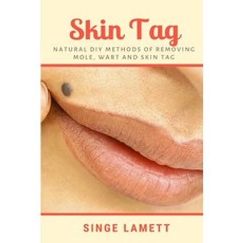 Skin Tag: Natural DIY Methods of removing Mole Wart and Skin Tag Paperback, Lulu.com, English, 9781794811737
