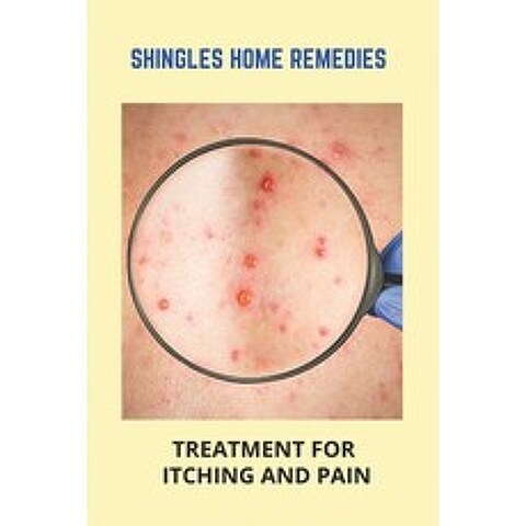 Shingles Home Remedies: Treatment For Itching And Pain: Shingles Recovery Stages Paperback, Independently Published, English, 9798740447803