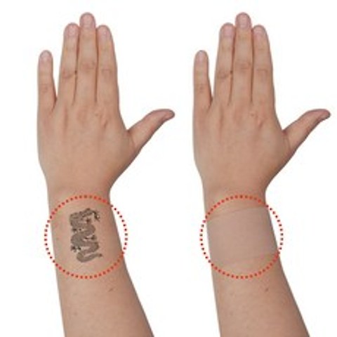 RM(로이엠제이) 타투커버 문신 흉터 가리기 문신커버