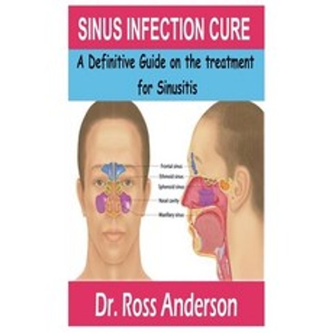 Sinus Infection Cure: A Definitive Guide on the treatment for Sinusitis Paperback, Independently Published, English, 9798676356668