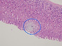 Hematoxylin에 의한 염색..