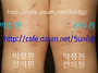 38 아토피치료 (무릎 뒤)