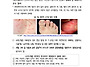 수족구 관련 주의사항