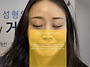 꺼진눈 눈지방이식 수술시..