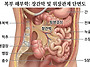 장간막 복막전이, 혈관과 ..