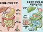 간암 소화가 잘되는 식사의..