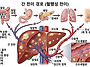암세포 왜 간으로 전이될까..