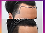 [20대 남자 M자탈모 머리..